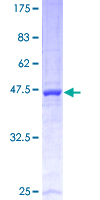 UBE2E3 Protein - 12.5% SDS-PAGE of human UBE2E3 stained with Coomassie Blue