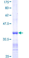 UBE2E3 Protein - 12.5% SDS-PAGE Stained with Coomassie Blue.