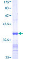 UBE2E3 Protein - 12.5% SDS-PAGE Stained with Coomassie Blue.