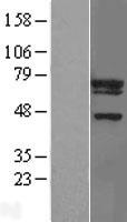 UBE2F Protein - Western validation with an anti-DDK antibody * L: Control HEK293 lysate R: Over-expression lysate