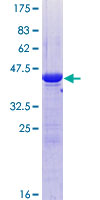UBE2G1 Protein - 12.5% SDS-PAGE of human UBE2G1 stained with Coomassie Blue