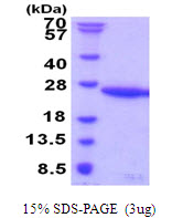 UBE2G1 Protein