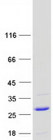 UBE2G1 Protein - Purified recombinant protein UBE2G1 was analyzed by SDS-PAGE gel and Coomassie Blue Staining