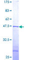 UBE2G2 Protein - 12.5% SDS-PAGE of human UBE2G2 stained with Coomassie Blue