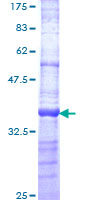 UBE2G2 Protein - 12.5% SDS-PAGE Stained with Coomassie Blue.