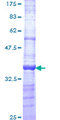 UBE2G2 Protein - 12.5% SDS-PAGE Stained with Coomassie Blue.