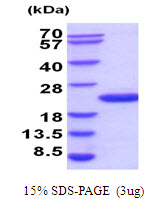 UBE2G2 Protein