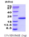 UBE2G2 Protein