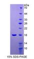 UBE2I / UBC9 Protein - Recombinant Ubiquitin Conjugating Enzyme E2I By SDS-PAGE