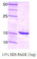 UBE2I / UBC9 Protein