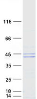 UBE2J1 Protein - Purified recombinant protein UBE2J1 was analyzed by SDS-PAGE gel and Coomassie Blue Staining
