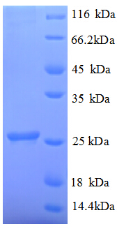 UBE2K / LIG Protein