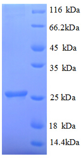 UBE2K / LIG Protein