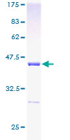 UBE2L3 / UBCH7 Protein - 12.5% SDS-PAGE of human UBE2L3 stained with Coomassie Blue