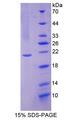 UBE2L3 / UBCH7 Protein - Recombinant Ubiquitin Conjugating Enzyme E2L3 By SDS-PAGE