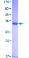 UBE2L6 Protein - 12.5% SDS-PAGE of human UBE2L6 stained with Coomassie Blue