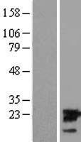 UBE2M / UBC12 Protein - Western validation with an anti-DDK antibody * L: Control HEK293 lysate R: Over-expression lysate