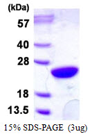 UBE2M / UBC12 Protein
