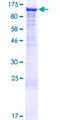 UBE2O Protein - 12.5% SDS-PAGE of human UBE2O stained with Coomassie Blue
