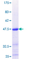 UBE2O Protein - 12.5% SDS-PAGE Stained with Coomassie Blue.