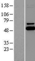 UBE2Q1 Protein - Western validation with an anti-DDK antibody * L: Control HEK293 lysate R: Over-expression lysate