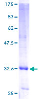 UBE2Q1 Protein - 12.5% SDS-PAGE of human UBE2Q stained with Coomassie Blue
