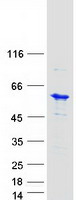 UBE2Q1 Protein - Purified recombinant protein UBE2Q1 was analyzed by SDS-PAGE gel and Coomassie Blue Staining