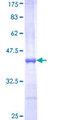 UBE2Q2 Protein - 12.5% SDS-PAGE Stained with Coomassie Blue.