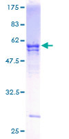 UBE2R2 Protein - 12.5% SDS-PAGE of human UBE2R2 stained with Coomassie Blue