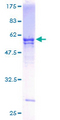 UBE2R2 Protein - 12.5% SDS-PAGE of human UBE2R2 stained with Coomassie Blue