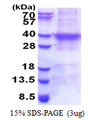 UBE2R2 Protein