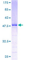 UBE2S / E2 EPF Protein - 12.5% SDS-PAGE of human UBE2S stained with Coomassie Blue