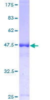 UBE2T / HSPC150 Protein - 12.5% SDS-PAGE of human UBE2T stained with Coomassie Blue