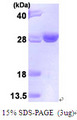 UBE2T / HSPC150 Protein