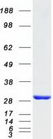 UBE2T / HSPC150 Protein - Purified recombinant protein UBE2T was analyzed by SDS-PAGE gel and Coomassie Blue Staining