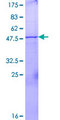 UBE2U Protein - 12.5% SDS-PAGE of human UBE2U stained with Coomassie Blue