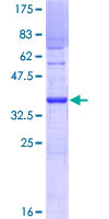 UBE2U Protein - 12.5% SDS-PAGE Stained with Coomassie Blue.