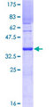 UBE2U Protein - 12.5% SDS-PAGE Stained with Coomassie Blue.
