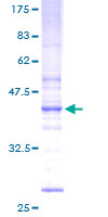 UBE2W Protein - 12.5% SDS-PAGE of human FLJ11011 stained with Coomassie Blue