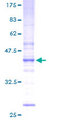 UBE2W Protein - 12.5% SDS-PAGE of human FLJ11011 stained with Coomassie Blue