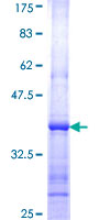 UBE2W Protein - 12.5% SDS-PAGE Stained with Coomassie Blue.