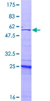 UBE2Z / USE1 Protein - 12.5% SDS-PAGE of human UBE2Z stained with Coomassie Blue