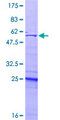 UBE2Z / USE1 Protein - 12.5% SDS-PAGE of human UBE2Z stained with Coomassie Blue