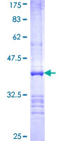 UBE2Z / USE1 Protein - 12.5% SDS-PAGE Stained with Coomassie Blue.