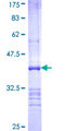 UBE2Z / USE1 Protein - 12.5% SDS-PAGE Stained with Coomassie Blue.