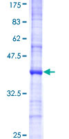 UBE3B Protein - 12.5% SDS-PAGE Stained with Coomassie Blue.