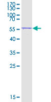 UBE3B Protein - 12.5% SDS-PAGE Stained with Coomassie Blue