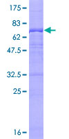 UBE3C Protein - 12.5% SDS-PAGE of human UBE3C stained with Coomassie Blue