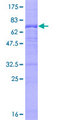 UBE3C Protein - 12.5% SDS-PAGE of human UBE3C stained with Coomassie Blue