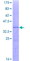 UBE3C Protein - 12.5% SDS-PAGE Stained with Coomassie Blue.
